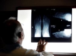 La coûteuse vérité sur l'assurance vie « sans examen médical »